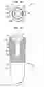 Fig. 02 - Dental implant and abutment mating system