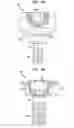 Fig. 09 - Dental implant and abutment mating system