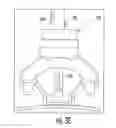 Fig. 07 - Imaging device for MRI-guided medical interventional systems