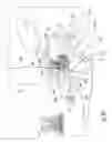 Fig. 44 - Imaging device for MRI-guided medical interventional systems