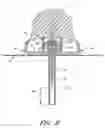 Fig. 09 - Infusion set