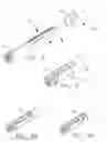 Fig. 03 - Method for deploying a device for gastric volume reduction