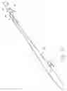 Fig. 09 - Method for deploying a device for gastric volume reduction