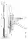 Fig. 28 - Method for deploying a device for gastric volume reduction