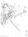 Fig. 37 - Method for deploying a device for gastric volume reduction