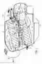 Fig. 02 - Volume-efficient filter