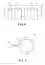 Fig. 07 - X-ray CT device and method of manufacturing the same