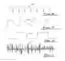 Fig. 04 - In-Band Parametric Sound Generation System