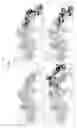 Fig. 27 - Disulfide trap MHC class I molecules and uses therefor