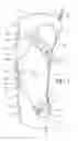 Fig. 02 - Orthopedic device having anteroposterior articulation