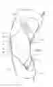 Fig. 04 - Orthopedic device having anteroposterior articulation