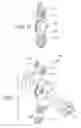 Fig. 08 - Orthopedic device having anteroposterior articulation