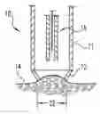 Fig. 01 - Devices and methods for expression of bodily fluids from an incision