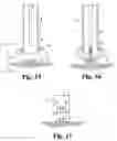 Fig. 06 - Devices and methods for expression of bodily fluids from an incision