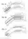 Fig. 02 - ENDOPROSTHESIS WITH POROUS RESERVOIR AND NON-POLYMER DIFFUSION LAYER