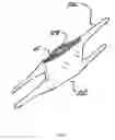 Fig. 02 - DISPOSABLE ICE BAG