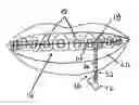 Fig. 01 - Quickly attachable and detachable decorations for orthodonthic braces