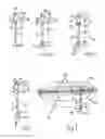Fig. 02 - Quickly attachable and detachable decorations for orthodonthic braces