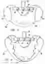 Fig. 03 - Sleep appliance