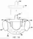 Fig. 14 - Sleep appliance