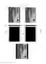 Fig. 07 - Method of identifying target synchronization point pair through scan-line image matching scheme