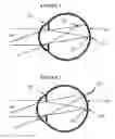 Fig. 02 - Methods and apparatuses for enhancing peripheral vision