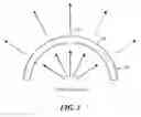 Fig. 04 - Slotted x-ray filter