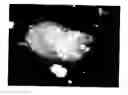 Fig. 01 - Targeted Therapy