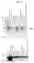 Fig. 22 - Human Protooncogene TRG and Protein Encoded Therein