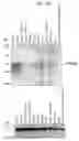Fig. 32 - Human Protooncogene TRG and Protein Encoded Therein