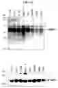 Fig. 45 - Human Protooncogene TRG and Protein Encoded Therein