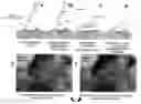 Fig. 01 - Identification of tissue for debridement