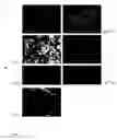 Fig. 07 - Modified spider silk proteins