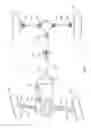 Fig. 02 - Grease reduction insert
