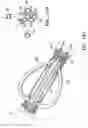 Fig. 07 - Methods for asymmetrical irradiation of a body cavity