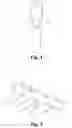 Fig. 02 - Lancet protective cap