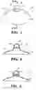 Fig. 02 - DEVICES AND METHODS FOR REMOVAL OF LEUKOCYTES FROM BREAST MILK
