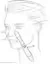 Fig. 01 - Skin treatment device