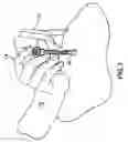 Fig. 09 - METHODS AND DEVICES FOR IMPROVING DELIVERY OF A SUBSTANCE TO SKIN