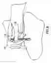 Fig. 10 - METHODS AND DEVICES FOR IMPROVING DELIVERY OF A SUBSTANCE TO SKIN