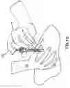 Fig. 12 - METHODS AND DEVICES FOR IMPROVING DELIVERY OF A SUBSTANCE TO SKIN