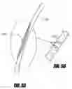 Fig. 33 - Methods and apparatus for treatment of hollow anatomical structures