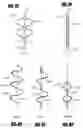 Fig. 43 - Methods and apparatus for treatment of hollow anatomical structures