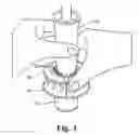 Fig. 04 - Surgical Cutting Instrument for Breast Surgery