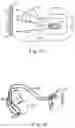 Fig. 02 - Method and apparatus for beat alignment and comparison
