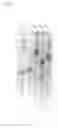 Fig. 04 - Regeneration