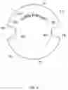 Fig. 06 - Trap for flying insects