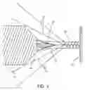 Fig. 03 - Strip lined catheters and methods for constructing and processing strip lined catheters