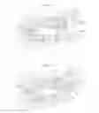 Fig. 04 - Trailer braking device
