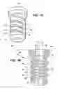 Fig. 02 - INSULATOR FOR VEHICLE SUSPENSION SYSTEM